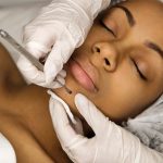 facial with extractions in Scottsdale, AZ