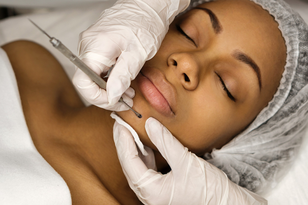 facial with extractions in Scottsdale, AZ